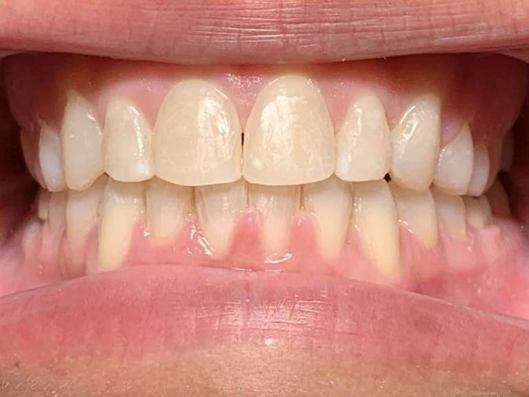Media PA Dentist Before & After Photos