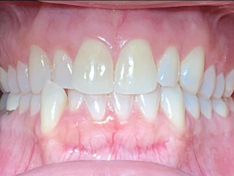 Media PA Dentist Before & After Photos