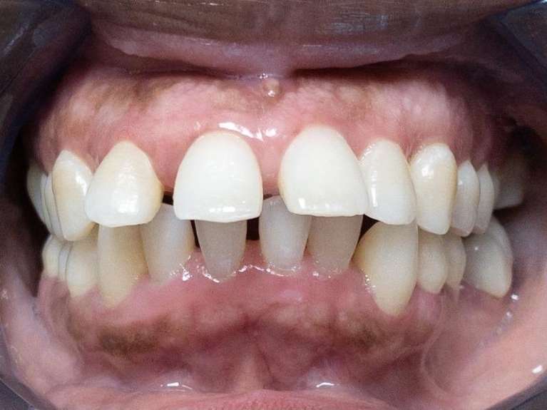 Media PA Dentist Before & After Photos