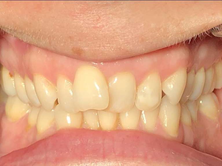 Media PA Dentist Before & After Photos